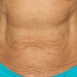 ba_30_before